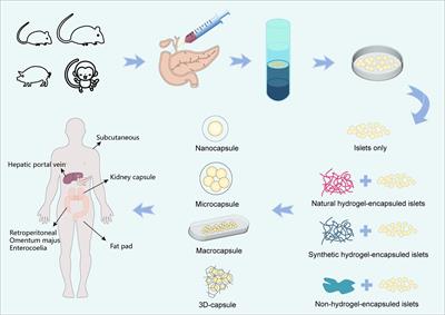 Frontiers Islet Encapsulation New Developments For The Treatment Of